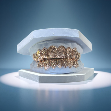Rose Cut Gold Grill