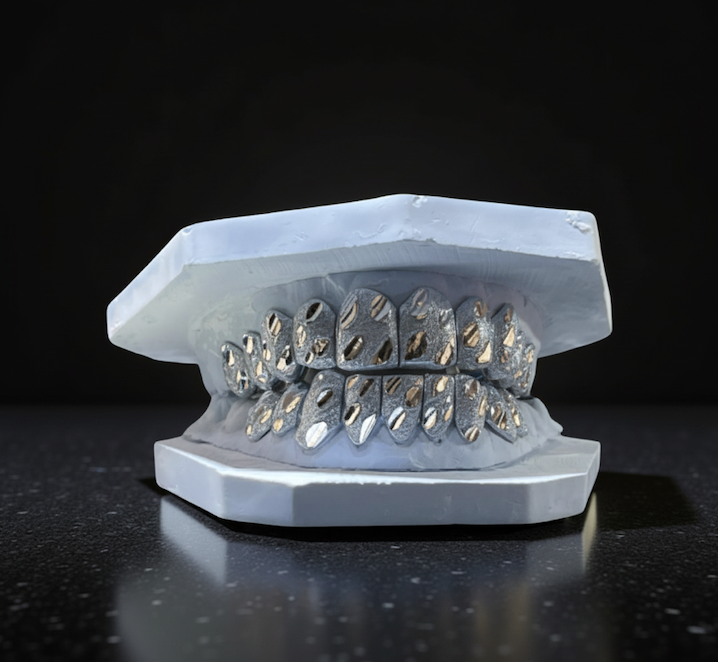 GOLD NUGGET CUT GRILL